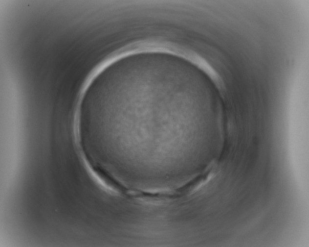 X0000113861528200910011011