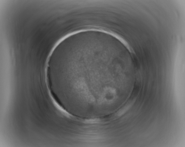 X0000113861535200910011011