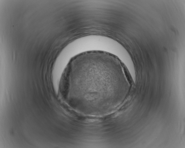 X0000113860137200910081714