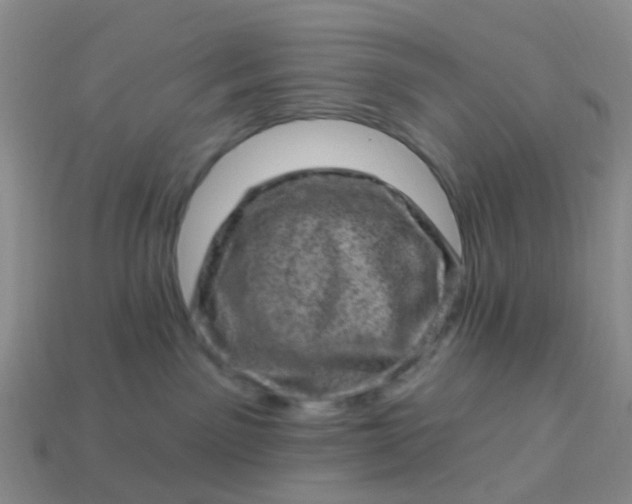 X0000113860141200910081714