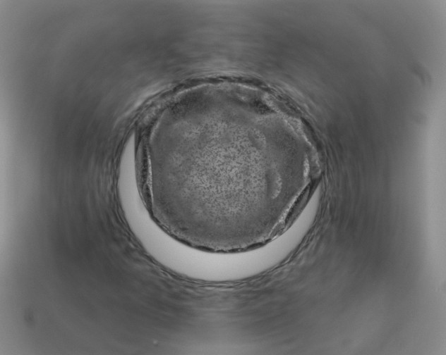 X0000113861157200910081700