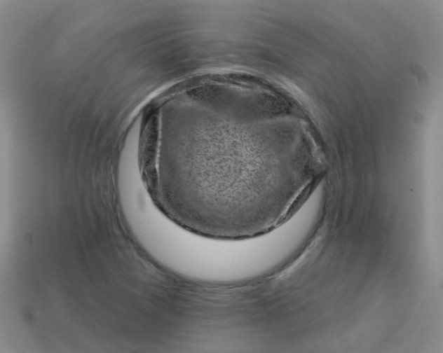 X0000113861361200910081657