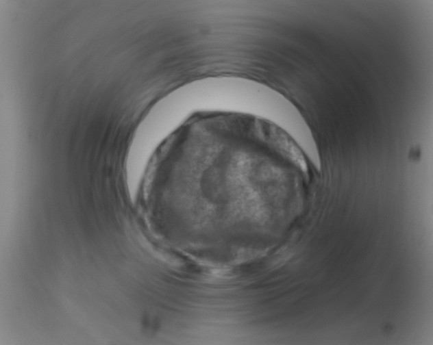X0000113860141200910151245