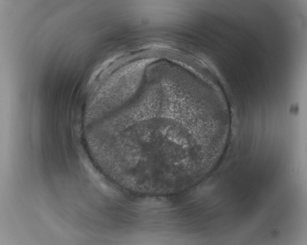 X0000113860386200910151241