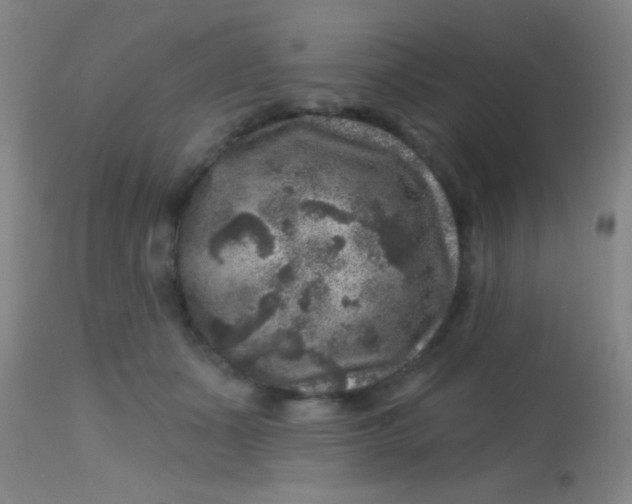 X0000113860511200910151239