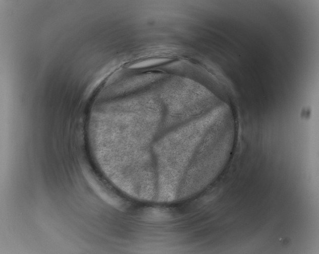 X0000113860250200910221447