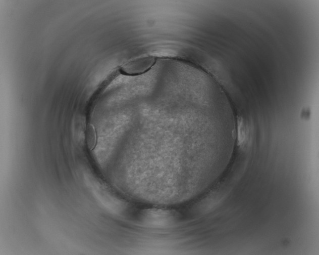 X0000113860300200910221447