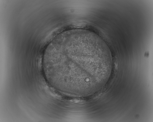 X0000113860745200910221441
