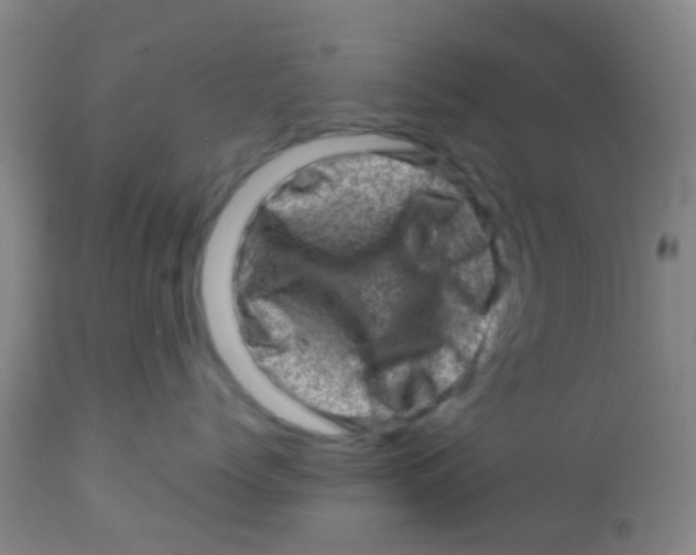 X0000113860768200910221441