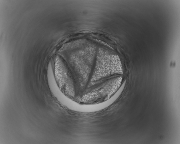 X0000113861057200910221436