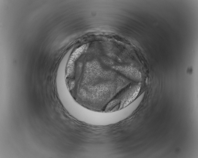 X0000113861110200910221435
