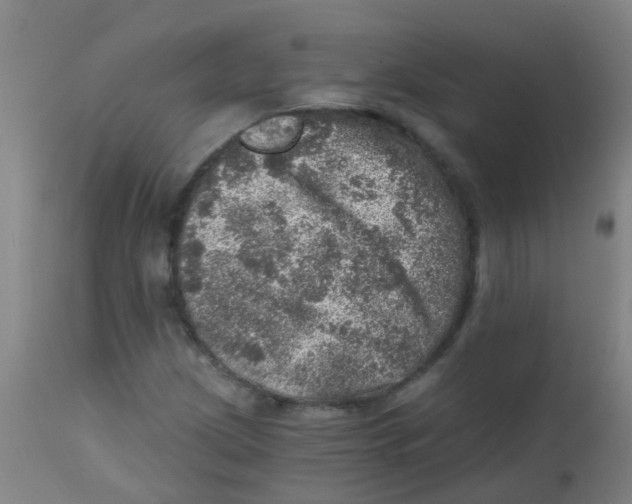X0000113861209200910221433