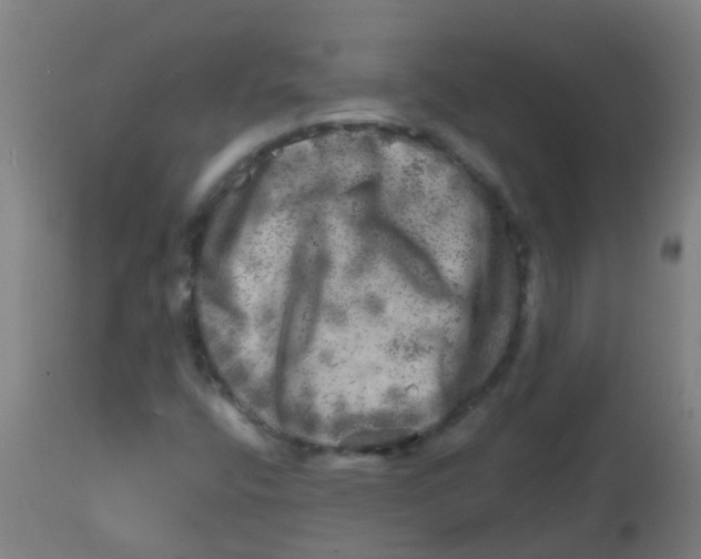 X0000113861400200910221431