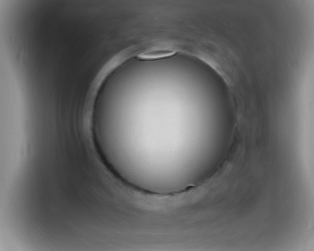 X0000113870007200910011121