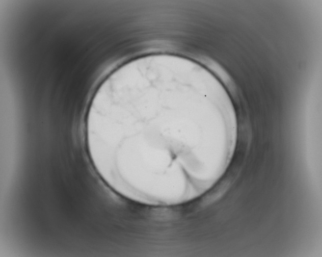 X0000113870807200910011111