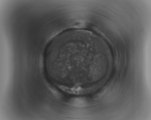 X0000113880303200909241358