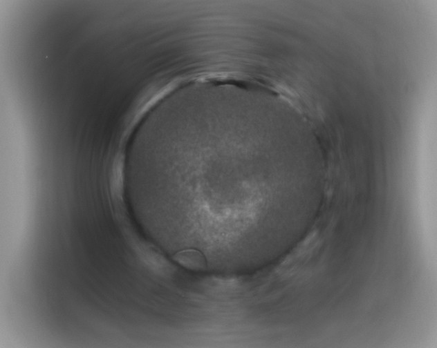 X0000113880194200910011139