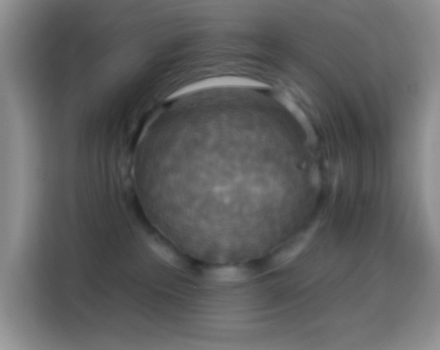 X0000113880237200910011138