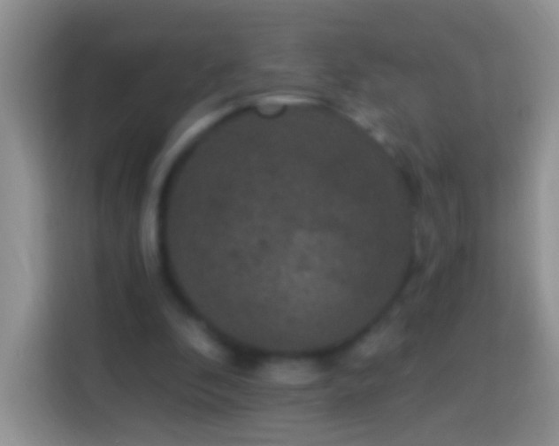 X0000113880296200910011138