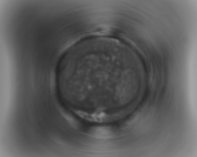 X0000113880303200910011138