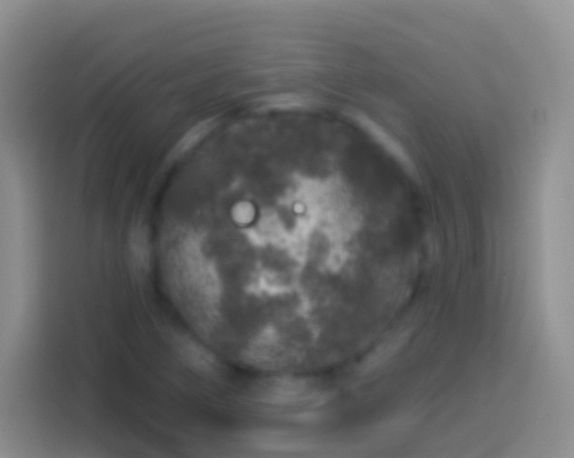 X0000113881266200910011125