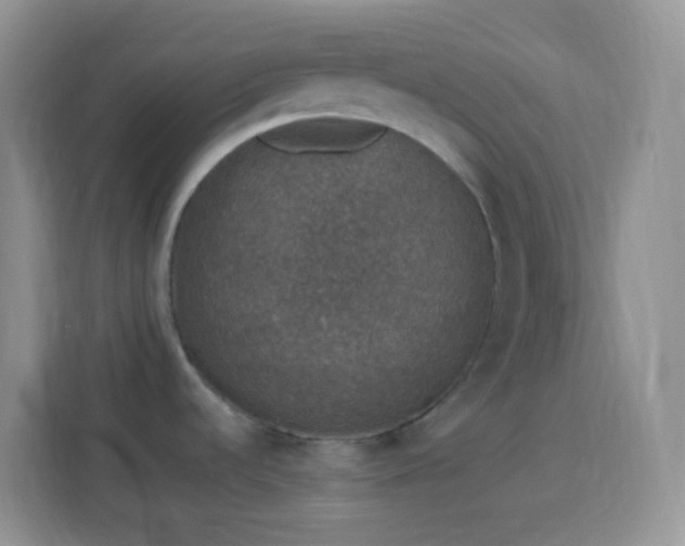 X0000113881536200910011122