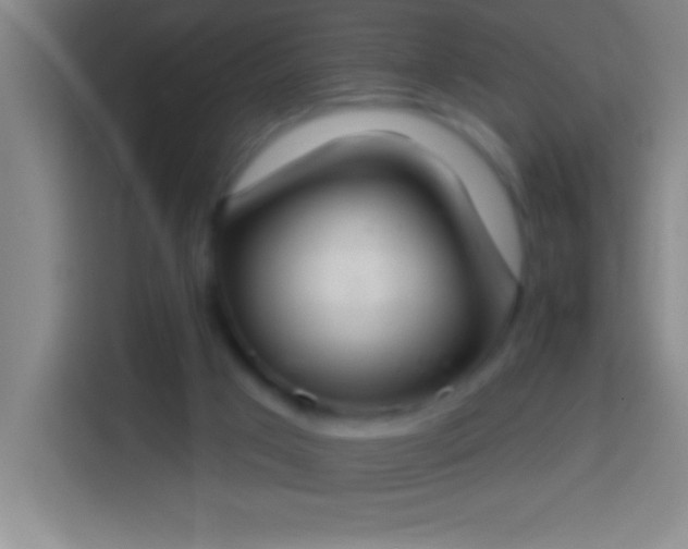 X0000113900017200910011352