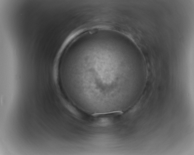 X0000113900056200910011351