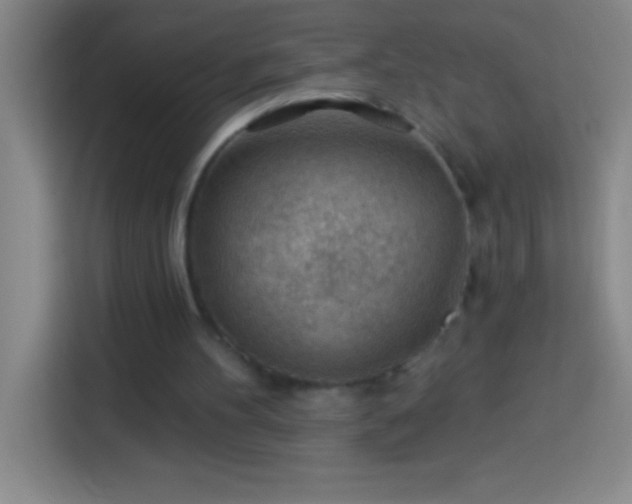 X0000113900100200910011351