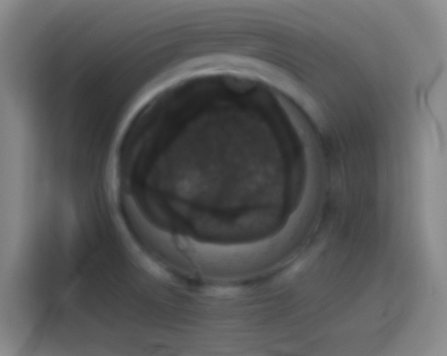 X0000113911522200910011438