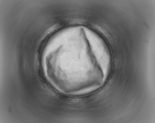 X0000113911219200910151411