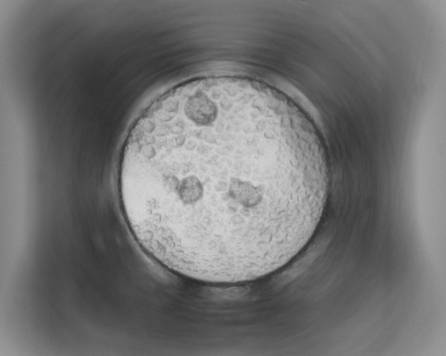 X0000113911429200910221324