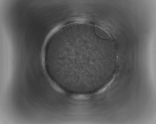 X0000113920149200909241537