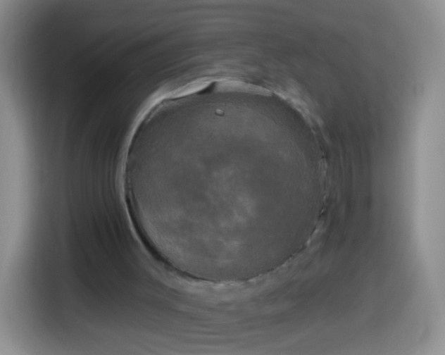 X0000113920003200910011521