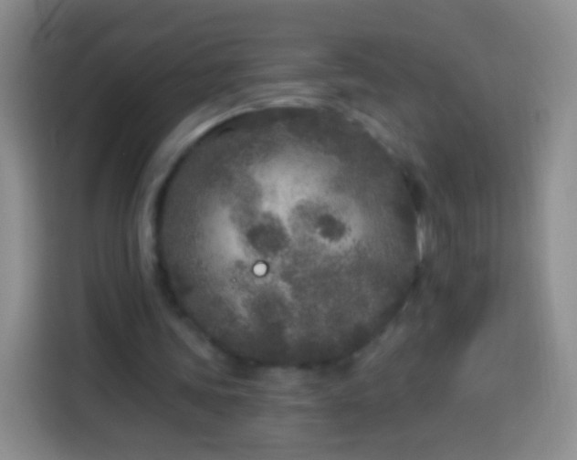 X0000113920339200910011516