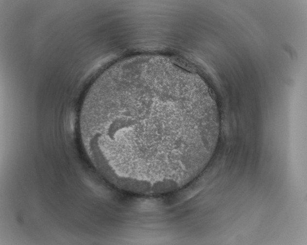 X0000113920115200910151448