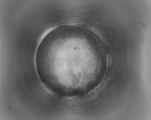 X0000113920147200910151447