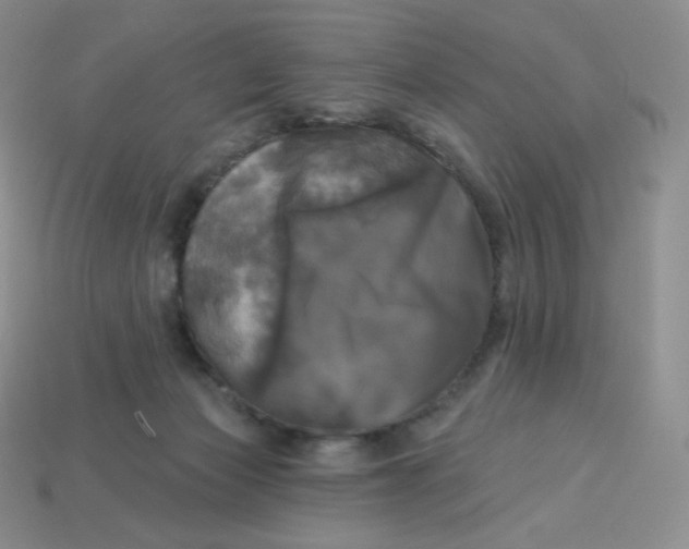 X0000113920173200910151448