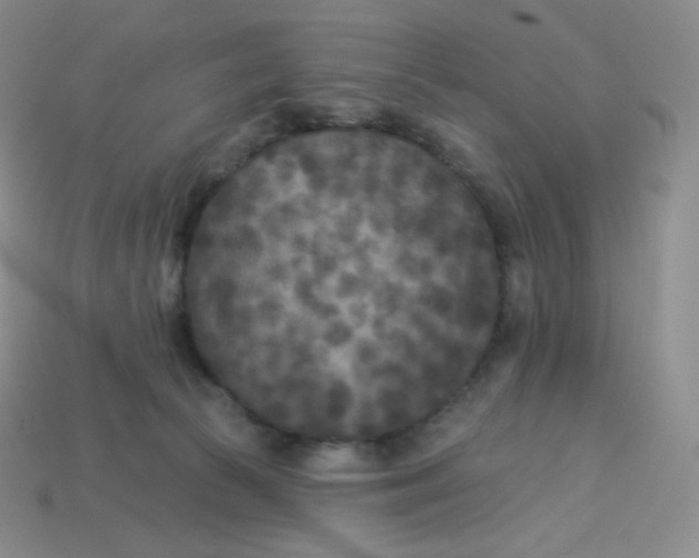 X0000113920177200910151448