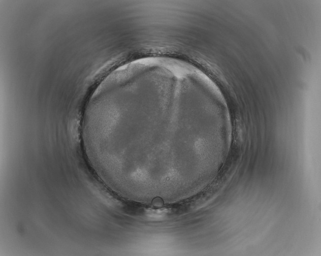 X0000113920450200910151443