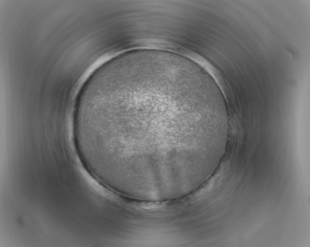 X0000113921147200910151434