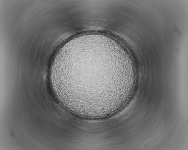 X0000113921257200910151432