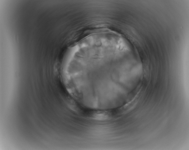 X0000113920175200910221401