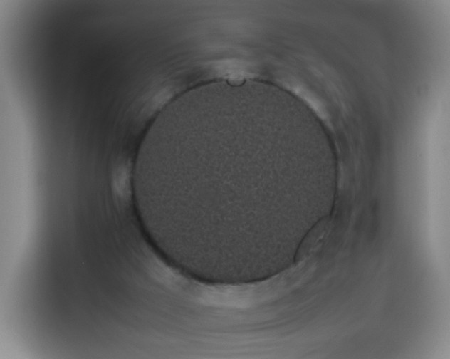 X0000113930009200910021251