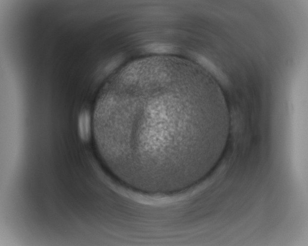 X0000113930014200910021251