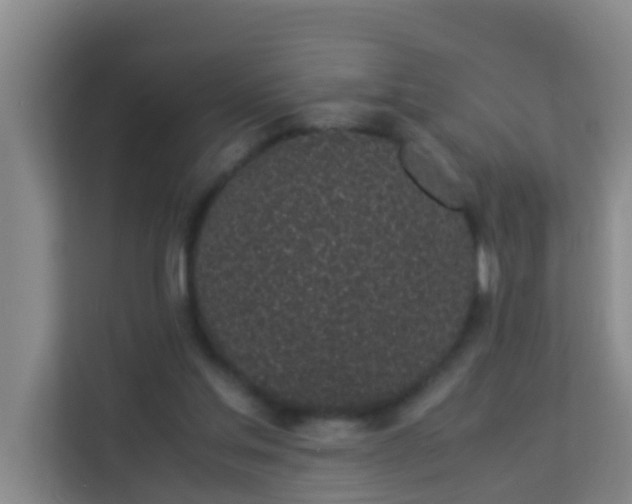 X0000113930205200910091609