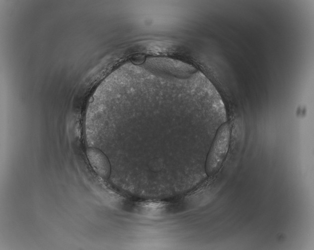 X0000113930313200911061225