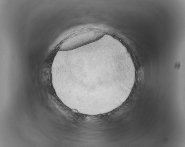 X0000113931496200911061207