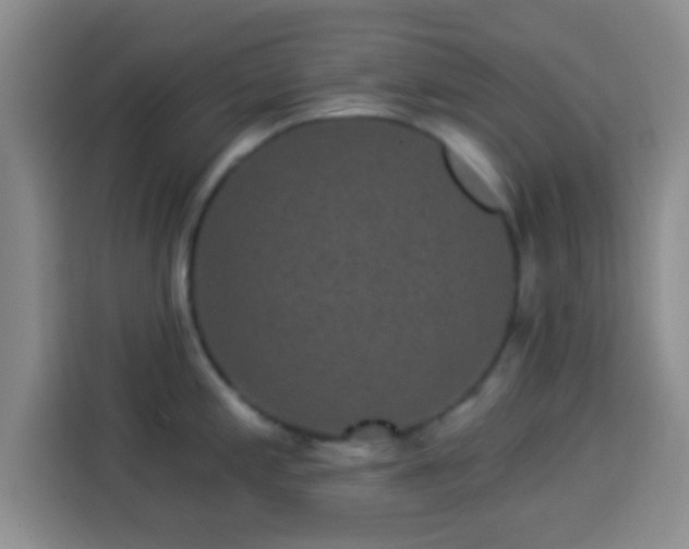 X0000113941197200910021256