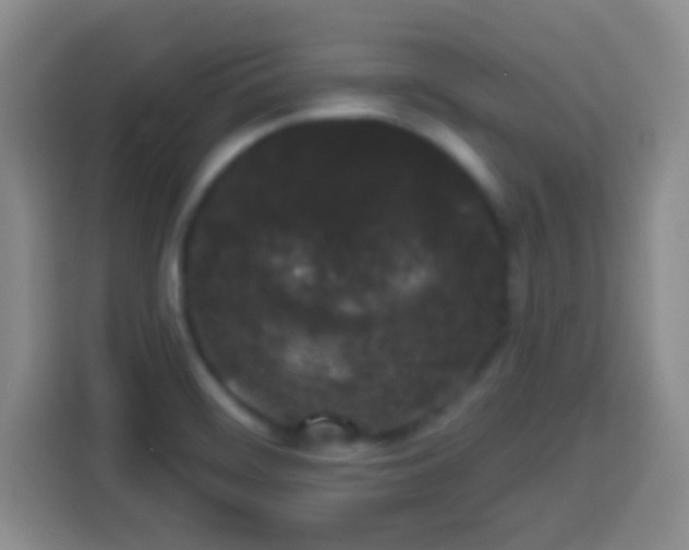 X0000113941468200910021252